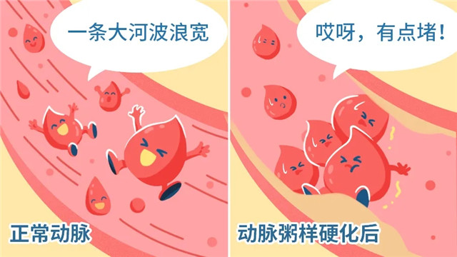 The first batch of post-00s already had high blood lipids! To lower fat, these three misconceptions should not be stepped on